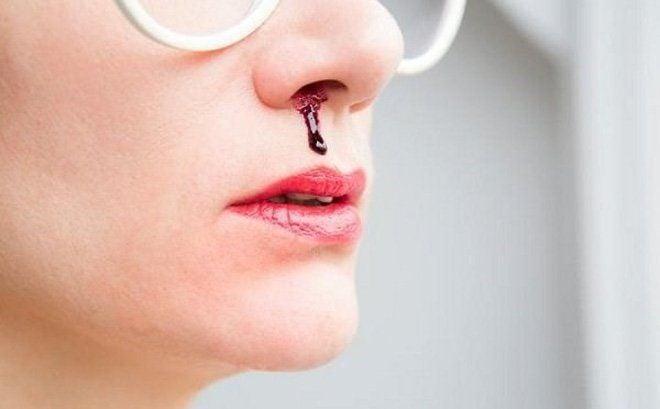 Các trường hợp chảy máu mũi trong giấc mơ và số đề liên quan