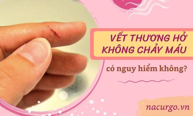 Nằm Mơ Thấy Chó Cắn Vào Tay: Điềm Báo Gì?