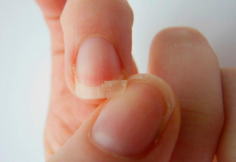 Nằm mơ thấy gãy móng tay cái đánh con gì?