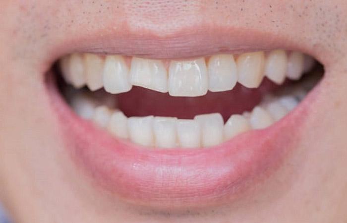 Nằm Mơ Thấy Vợ Chết Đánh Con Gì? Giải Mã Chính Xác