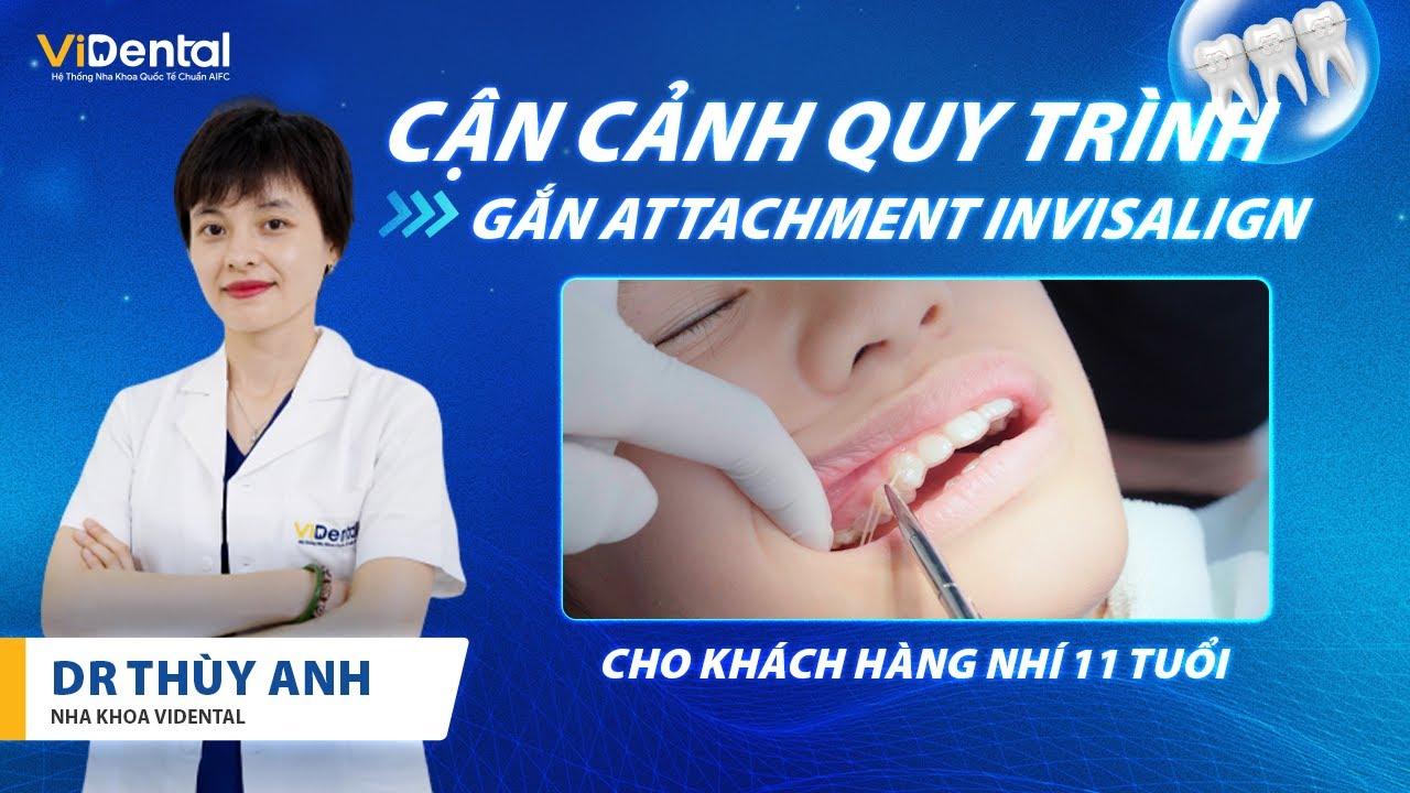 Nằm Mơ Thấy Chó Đen Chết: Giải Mã Và Ý Nghĩa