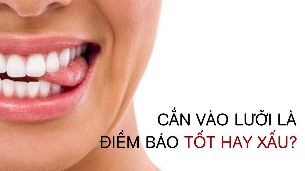 Nằm Mơ Thấy Mạng Nhện Ý Nghĩa Gì?