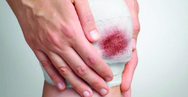 Nằm mơ thấy mình bị chém đầu: Giải mã và con số may mắn