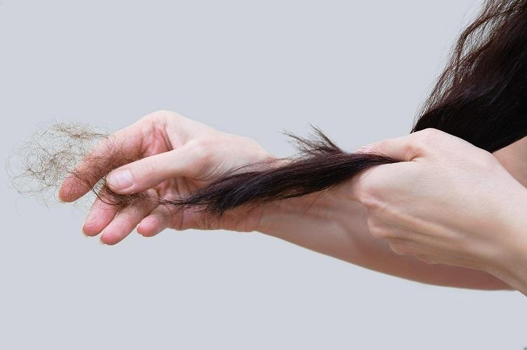 Nằm mơ thấy người khác rụng tóc