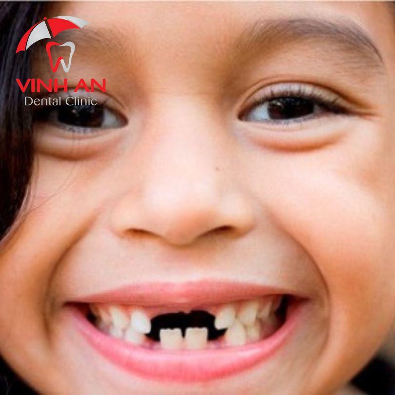 Nằm mơ thấy nhổ răng không chảy máu: Giải mã giấc mơ và con số may mắn