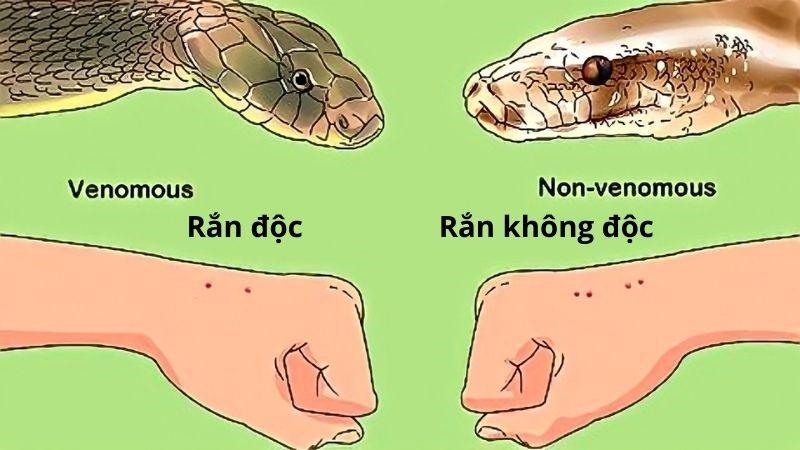 Rắn xanh cắn vào tay
