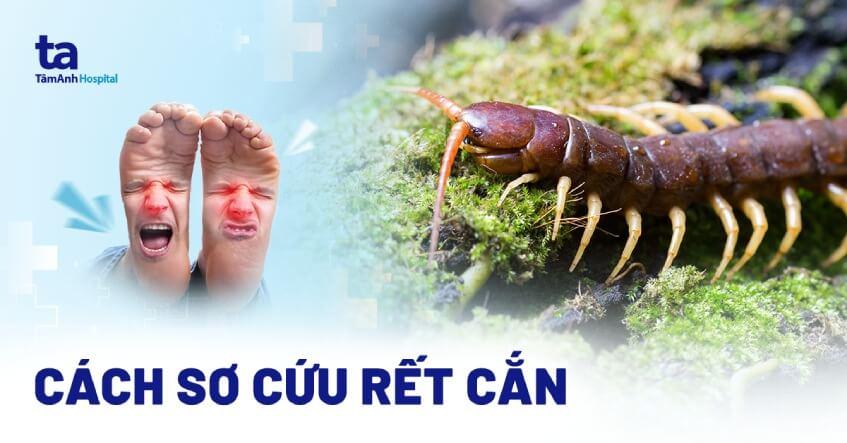 Rết cắn chân đánh con gì?